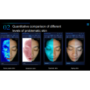 Novalis Pro